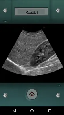 Scanner X-ray android App screenshot 2