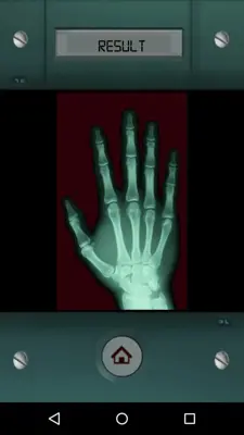 Scanner X-ray android App screenshot 4